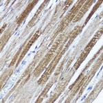 KV4.3 (KCND3) Polyclonal Antibody