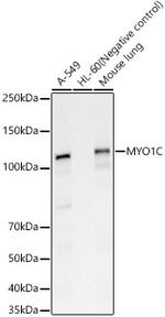 MYO1C Antibody in Western Blot (WB)