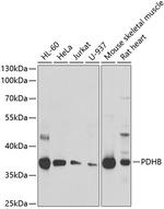 PDHB Polyclonal Antibody