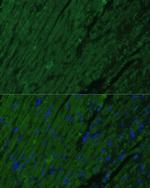 Cardiac Troponin I Polyclonal Antibody
