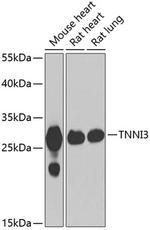 Cardiac Troponin I Antibody in Western Blot (WB)