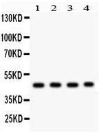 MBD2 Polyclonal Antibody