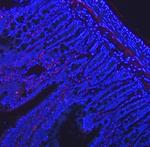 VIP Polyclonal Antibody