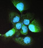 ADH5 Polyclonal Antibody