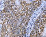 CD44 Antibody in Immunohistochemistry (Paraffin) (IHC (P))