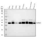 ERK1/ERK2 Antibody in Western Blot (WB)