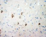 NSE Polyclonal Antibody