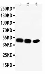 CCR6 Polyclonal Antibody