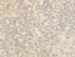 Cullin 4B Polyclonal Antibody