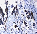 Cytokeratin 8 Antibody in Immunohistochemistry (Paraffin) (IHC (P))
