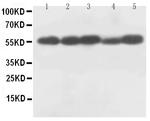 Caspase 8 p18 Polyclonal Antibody
