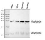 Phospholamban Polyclonal Antibody