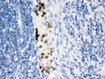 FABP3 Polyclonal Antibody