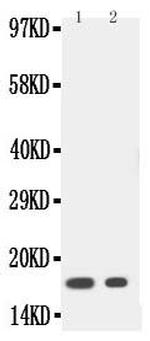 IL-1 beta Antibody in Western Blot (WB)