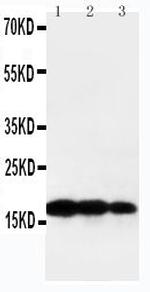 Human TNF beta Polyclonal Antibody