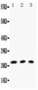 Human TNF beta Polyclonal Antibody