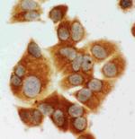 MEK1 Polyclonal Antibody