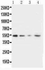 MMP10 Polyclonal Antibody