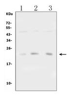 TIMP1 Antibody in Western Blot (WB)