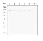 PI3K p85 alpha Polyclonal Antibody