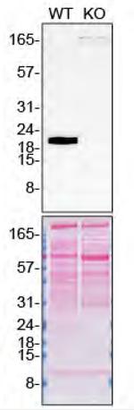 Pleiotrophin Polyclonal Antibody