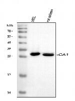 Carbonic Anhydrase I Polyclonal Antibody