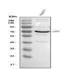 Osteopontin Antibody in Western Blot (WB)