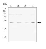 FGF22 Polyclonal Antibody