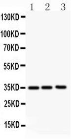 GM-CSF Antibody in Western Blot (WB)