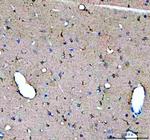 GDNF Antibody in Immunohistochemistry (Paraffin) (IHC (P))