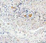 GDNF Polyclonal Antibody