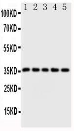 FosB Polyclonal Antibody