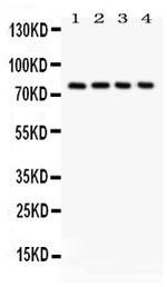 Tau Antibody in Western Blot (WB)
