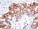 GCLC Polyclonal Antibody