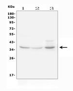IGFBP3 Polyclonal Antibody