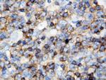 CD45 Antibody in Immunohistochemistry (Paraffin) (IHC (P))