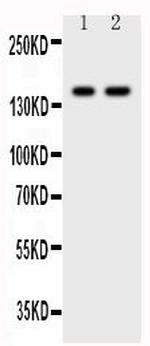 CD45 Antibody in Western Blot (WB)