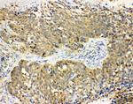 Haptoglobin Antibody in Immunohistochemistry (Paraffin) (IHC (P))
