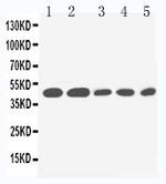 IL2RG Polyclonal Antibody