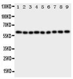 IL5RA Polyclonal Antibody
