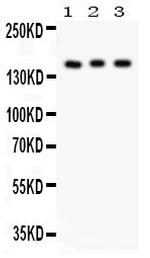 INSR Polyclonal Antibody