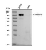 CD18 Antibody in Western Blot (WB)