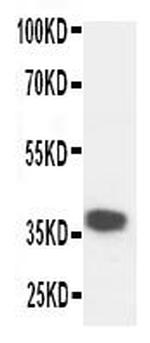 Kallikrein 5 Antibody in Western Blot (WB)