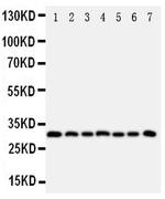 Kallikrein 11 Antibody in Western Blot (WB)