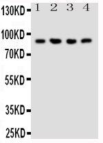 NRG2 Antibody in Western Blot (WB)