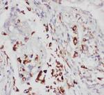 ALOX5 Polyclonal Antibody