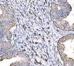 HTR1A Polyclonal Antibody