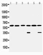 Monoamine Oxidase B Antibody in Western Blot (WB)