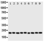Cytoglobin Polyclonal Antibody
