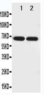 NTN1 Antibody in Western Blot (WB)